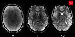 نخستین تصاویر از MRI با میدان 11.5 تسلا